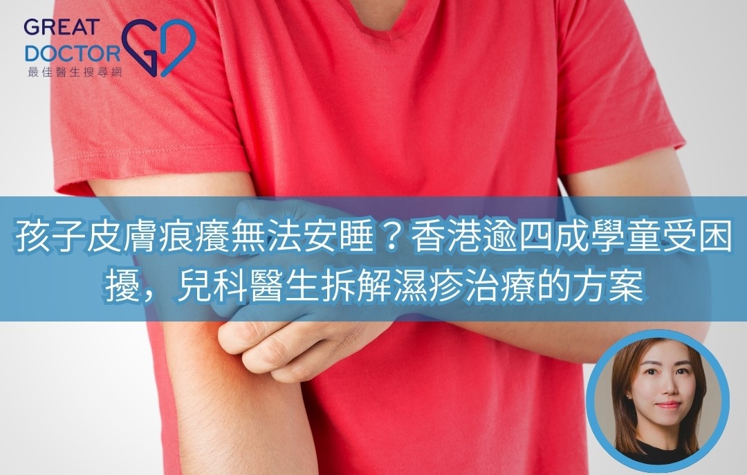 《Greatdoctor》報導:孩子皮膚痕癢無法安睡?香港逾四成學童受困擾,兒科醫生拆解濕疹治療的方案