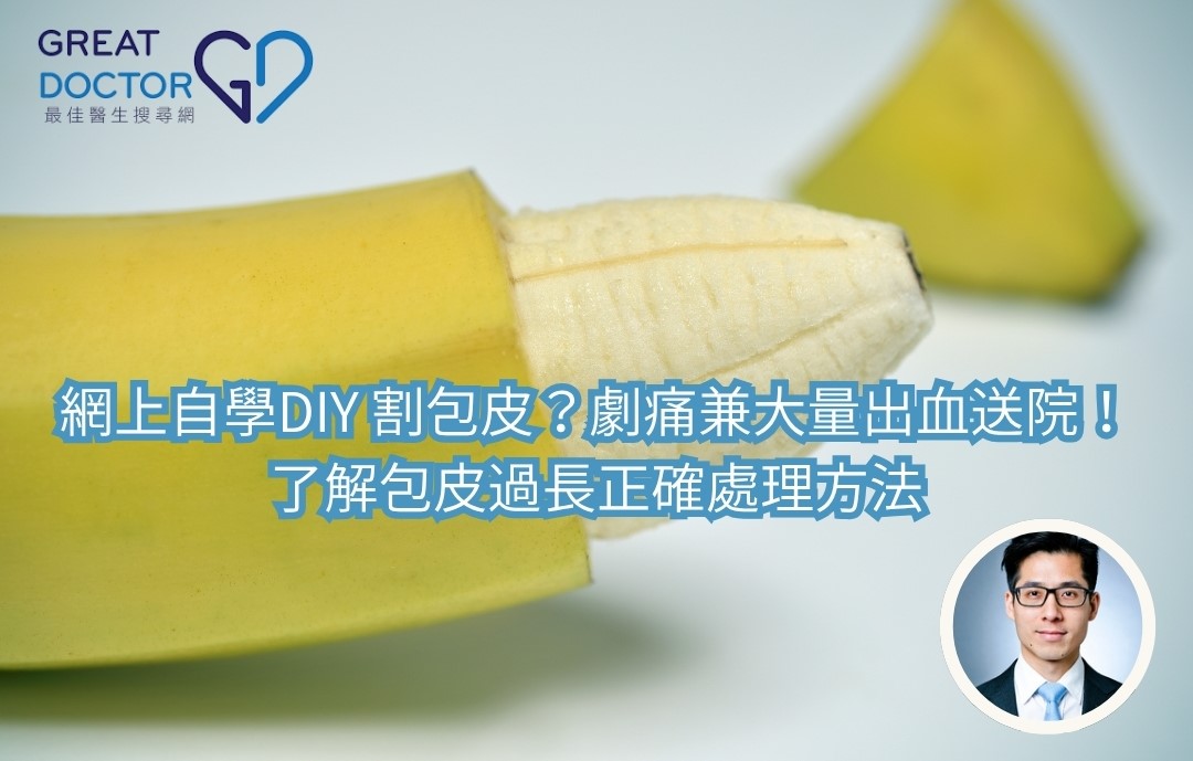 網上自學DIY 割包皮？劇痛兼大量出血送院！了解包皮過長正確處理方法