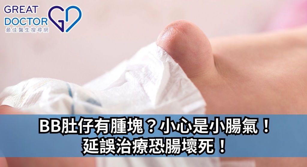 《Greatdoctor》報導：BB肚仔有腫塊？小心是小腸氣！延誤治療恐腸壞死！